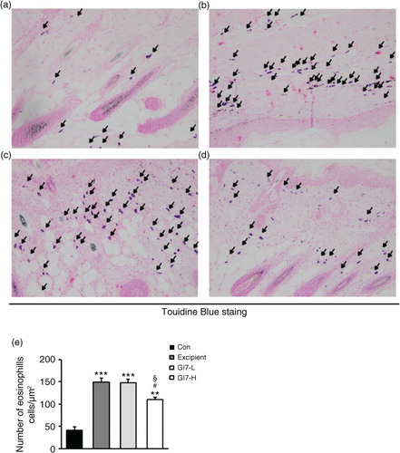 Fig. 5 Mast cell infiltration in the dorsal skin of mice. TB-stained dorsal skin lesions were observed in control (a), excipient (b), GI7-L (c), and GI7-H (d) groups. GI7-H is demonstrated to have an inhibitory effect on mast cell infiltration (arrow) of AD-like skin lesions compared with that of the excipient and GI7-L groups (e). Results are expressed as the mean+SD (n=6). **p<0.01, ***p<0.001 versus the control group; # p<0.05 versus the excipient group; § p<0.05 versus the GI7-L group.
