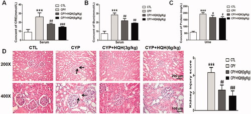 Figure 2. Effects of HQH on functional marker and morphological change in the kidneys of CYP-treated rats. (A) Serum creatinine. (B) Blood urea nitrogen. (C) Urine protein. (D) Kidney sections stained with H&E (magnification ×200 and ×400). The data are presented as the mean ± SD. n = 4. ***p < 0.001 versus the Control group. #p < 0.05, ##p < 0.01, and ###p < 0.001 versus the CYP group.