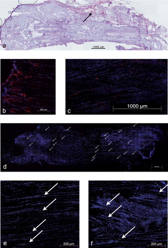 Figure 7. a. Factor VIII staining of a longitudinally sectioned soleus muscle 4 weeks after crush injury, showing the distribution of vessels in the injury zones. b. Cryo-section with an immunohistochemical stain for nestin in a healthy soleus muscle (counterstain: DAPI), myotendinous transition zone. c. Staining for nestin in a longitudinally sectioned soleus muscle (counterstain: DAPI). Nestin immunoreactivity was dispersed throughout the muscle and could be found not only at the tips of regenerating myofiber stumps but also at the lateral aspects of the fibers. d. Overview of a-bungarotoxin staining of a longitudinally sectioned soleus muscle (counterstain: DAPI). The white arrows indicate multiple, newly developed neural endplates in the proximal and distal crush zones of the muscle. e. Detail of panel d depicting a linear distribution of endplates in the uninjured region. f. Detail of panel d depicting endplates within the crushed area.