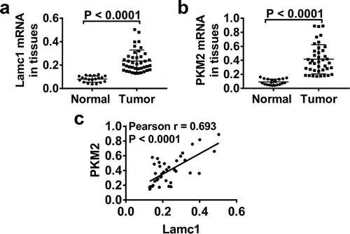 Figure 1. Lamc1 is significantly increased in tumors of HCC patients and associated with PKM2 expression Forty tumor and 20 adjacent normal tissues of HCC patients were collected. (a,b). After isolation of RNA, the expression of Lamc1 (a) and PKM2 (b) relative to GAPDH was detected by RT-PCR. (c) The correlation between Lamc1 and PKM2 was analyzed by Pearson’s analysis (P < 0.0001).