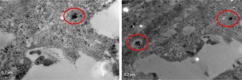 Figure 10 Transmission electron microscopy images.Note: Black dots circled by red circles represent nanoparticles.