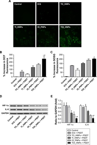 Figure 6 The underlying mechanism of therapy.Notes: (A) The intracellular ROS production was detected by fluorescence microscopy in SKOV3 cells incubated with DCFH-DA. Scale bar is 50 µm. (B) Percentage increase in DCF fluorescence for ICG, TO_HNPs, TI_HNPs, OI_PNPs, and TOI_HNPs incubated with SKOV3 cells upon exposure to laser and US measured by fluorescence microplate reader. (C) Percentage increase in SOSG fluorescence for ICG, TO_HNPs, TI_HNPs, OI_PNPs, and TOI_HNPs with laser and US exposure. (D, E) HIF-1α and IL-6 protein expression in SKOV3 cells was analyzed by Western blot after different treatments. GAPDH was used as an internal reference. Compared with control, *P<0.05; compared with other groups, #P<0.05.Abbreviations: DCF, 2′,7′-dichlorofluorescein; DCFH-DA, 2′,7′-dichlorofluorescin diacetate; HIF-1α, hypoxia-inducible factor 1-alpha; ICG, indocyanine green; LPHNPs, lipid–polymer hybrid nanoparticles; PFP, perfluoropentane; OI_PNPs, PLGA NPs-encapsulated ICG and PFP-carrying oxygen; SOSG, Singlet Oxygen Sensor Green; TOI_HNPs, folate-targeted LPHNPs-loaded ICG/PFP-carrying oxygen; US, ultrasound; PLGA, poly (lactic-co-glycolic acid); TO_HNPs, folate-targeted LPHNPs-loaded PFP-carrying oxygen; TI_HNPs, folate-targeted LPHNPs-loaded ICG; GAPDH, glyceraldehyde phosphate dehydrogenase.