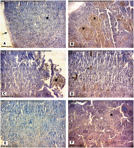 Figure 3. Representative photomicrographs of E. orientalis spleen tissue structures. (A) Control site: Red and white pulp, splenic capsule (arrow). (B) Petrochemical Station: Hemorrhage (black ). (C) Majidieh Station: Hemorrhages (black ). (D) Ghazaleh Station: Melano-macrophage aggregations (black arrows). (E) Gaafari Station: Relatively normal tissue structure. (F) Zangi Station: Normal tissue structure: Red pulp (white ), white pulp (black ). All samples; H&E-stained, magnification = ×725).