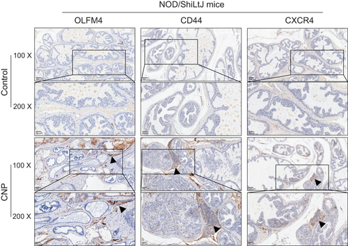 Figure 3 Immunohistochemistry (IHC) analyses of the immune-related markers, CD44, CXCR4, and OLFM4 between prostate tissues derived from chronic nonbacteria prostatitis (CNP) and negative controls.