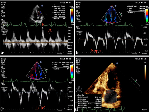 Figure 1 Transthoracic two-dimensional echocardiography in patients with gout. (a) Peak mitral valve velocities in early diastole (E) and late diastole (A) were measured using a pulsed Doppler. (b) Doppler measurements of septal mitral annular early diastolic motion velocity (Sepe’). (c) Doppler measurements of lateral mitral annular early diastolic motion velocity (Late’). (d) The left atrial volume index (LAVI) was calculated by the biplane Simpson method.