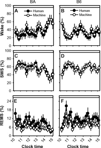Figure 5 Sleep-state percentages in human-scored versus machine-scored 2-second epoch data.