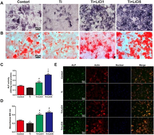 Figure 7 Osteogenic differentiation effect of macrophage-conditioned medium.Notes: (A) ALP staining and (B) ARS staining of rBMSCs cultured in conditioned medium for 14 days. (C) ALP activity of rBMSCs cultured in conditioned medium for 14 days. (D) Quantitative analysis of Alizarin red staining. (E) ALP immunofluorescent staining of rBMSCs cultured in conditioned medium: ALP (green), actin (red), nuclear (blue). scale bar: 50 μm. (*# and + represent P<0.05 when compared with Control, Ti, and Ti+LiCl1 respectively).Abbreviations: ALP, Alkaline phosphatase; ARS, alizarin red staining; rBMSCs, rat bone marrow mesenchymal stem cells.