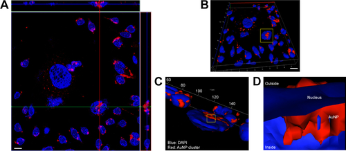 Figure S1 Ortho image assembled from Z-stack (A) (scale bar: 20 µm), present the place of incorporation of gold nanoparticles (AuNPs) into cell nucleus (crosslink section), after 6 hours of incubation. A 3D view of the ortho image is presented at (B) (scale bar: 20 µm). More details about the incorporated AuNPs can be seen in (C) and (D) on reconstructed images (image sizes: 60×70 µm, and 6×7 µm, respectively).