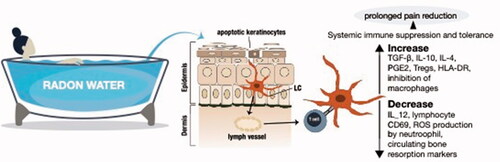 Figure 4. Mechanisms of action. The current school of thought suggests that there is enough alpha particle damage to cause apoptosis in a few keratinocytes or other epithelial cells, which in turn get phagocytosed by Langerhans cells (LC) or similar antigen presenting cells that migrate to the lymph nodes where they can modulate the immune balance systemically away from the pro-inflammatory Th1 bias (Deetjen et al. Citation2005). Much of this seems to rely on anti-inflammatory cytokines such as TGF-β and IL-10 either directly from dying cells or following uptake by neighboring phagocytes with the assumption that these cytokines are potent inhibitors of inflammatory processes such as leukocyte infiltration and macrophage/neutrophil function. This concept is largely an extrapolation from studies on ultraviolet (UV) radiation or low dose ionizing radiation. Nonetheless, there is growing evidence from clinical and pre-clinical studies that would support this therapeutic radon concept of rebalancing inflammatory/immune networks.