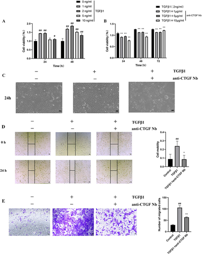 Figure 3 Effect of anti-CTGF Nb on proliferation and migration of LX-2 cells treated with TGFβ1. (A) CCK-8 assays showed proliferation change of cells. LX-2 cells were treated with the increased concentration of TGFβ1 (1, 2, 5, and 10 ng/mL) or an equal volume of PBS for 24 h. (B) Effect of anti-CTGF Nb at various concentrations (1, 5, and 10 μg/mL) on the proliferation of TGFβ1-treated LX-2 cells was determined by CCK-8 assay after 24, 48 or 72 h. (C) Morphology of LX-2 cells under different treatments for 24 h. (D) The migration rate of cells was detected by wound-healing test. Representative microphotographs showing the wound closure distance at 0h and 24 h post wounding. Dashed lines indicate initial wounds. Morphometrical analysis was performed to measure the remnant wounding area. The migration rate is shown as % of initial wounding area. (E) Cell mobility was detected by Transwell assay. Scale bars: 100 μm. All data are presented as mean ± SD from three independent experiments. #p < 0.05, ##p < 0.01 vs the control group; *p < 0.05, **p < 0.01 vs the TGFβ1 group.