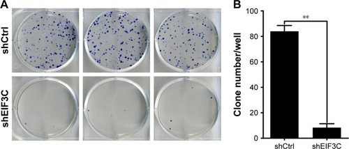 Figure 4 Knockdown of EIF3C suppresses colony formation in U-2OS cells.Notes: (A) Representative images of colony formation of U-2OS cells. (B) Colony formation of U-2OS cells treated with shEIF3C and shCtrl lentivirus. Data are expressed as the mean ± SD of three individual experiments (**P<0.01).