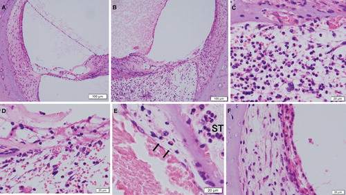 Figure 4. Histological sections from the inner ear in 28-day stimulation sides (H&E staining). (A) The saline injection side of the basal turn of the cochlea under low power field. (B) The ovalbumin (OVA) injection side of the basal turn of the cochlea. (C) The basilar membrane and the scala tympani of (B) under high power field. (D) The organ of Corti under high power field. (E) Migrating eosinophils (arrows) from vessels in the venules neighboring the scala tympani (ST). (F) The spiral ligament and the stria vascularis of (E) under high power field.