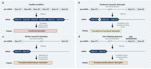 Figure 1. Representation of the DMD gene transcript splicing and dystrophin protein translation at different conditions. (A) In a healthy condition, functional dystrophin is translated from the mRNA with the correct reading frame. (B) In Duchenne muscular dystrophy, an out-of-frame exon 48–50 deletion results in splicing of exon 47 to 51 and translation of a prematurely truncated nonfunctional dystrophin. (C) In Becker muscular dystrophy, an in-frame exon 48–51 deletion results in splicing of exon 47 to 52 and translating of an internally truncated semi-functional dystrophin. (D) The exon skipping approach applied for an out-of-frame exon 48–50 deletion uses antisense oligonucleotides (AONs) that target exon 51 and hide it from the splicing machinery. This results in exon 51 exclusion, thus restoring the reading frame and allowing translation of a semi-functional BMD-like dystrophin. Created with BioRender.com.