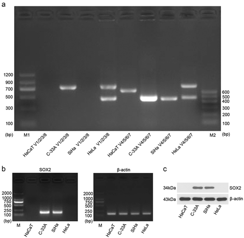 Figure 1. The expression profile of SOX2OT transcripts [Citation1–Citation8] and SOX2 in cervical cancer cell lines. (a) The transcripts of SOX2OT in cervical cancer cells were detected using Agarose gel electrophoresis. (b) The analysis of qRT-PCR and Agarose gel electrophoresis was used to detect the mRNA level of SOX2. (c) Western blot assay was performed to measure the protein level of SOX2.
