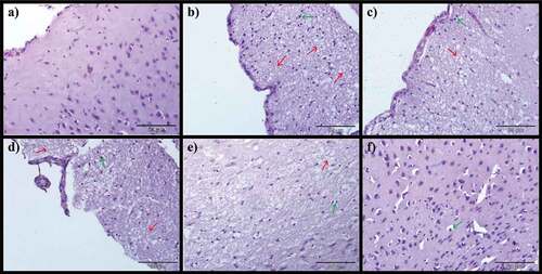 Figure 6. Photomicrographs of cerebrum: a) Control group, b) Model group, c) Donepezil, d) CA 200, e) CA 400 and f) CA 800. H & E stain, magnification 40x, n = 3. Encephalomalacia of matrix brain (red arrow), diffuse gliosis (green arrow).