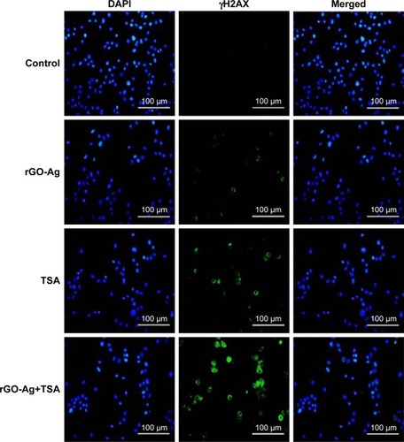 Figure 16 Estimation of nuclear DNA damage in SKOV3 cells after exposure to rGO-Ag or TSA alone or combination of rGO-Ag and TSA for 24 h using γH2AX antibody.Notes: Nuclear γH2AX foci was estimated in SKOV3 cells exposed to rGO-Ag (0.2 µM) alone, TSA (0.2 µM) alone, or combination of both rGO-Ag (0.2 µM) and TSA (0.2 µM) for 24 h. Scale bars =100 µm.Abbreviations: rGO-Ag, reduced graphene oxide-silver; TSA, trichostatin A.