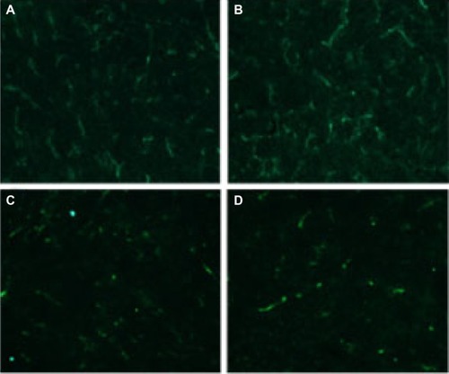 Figure 8 CD31 assay.Notes: Tumor tissue sections of NS-treated group (A), EM-treated group (B), free-Qu-treated group (C), and Qu-M-treated group (D) were immunostained with CD31 for evaluating the microvessel density. The results imply that antiangiogenesis may be another antitumor mechanism of Qu-M and free-Qu in vivo.Abbreviations: NS, normal saline; EM, empty MPEG–PCL nanomicelles; MPEG–PCL, monomethoxy poly(ethylene glycol)–poly(ε-caprolactone); free-Qu, free quercetin; Qu-M, quercetin-loaded MPEG–PCL nanomicelles.