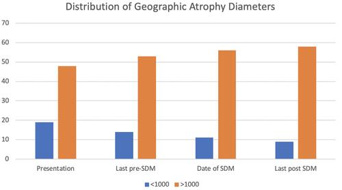 Figure 3 Distribution of geographic atrophy diameters at presentation; on date of last images prior to treatment; on date of fist panmacular SDM treatment; and at last visit following institution of regular periodic panmacular SDM treatment.