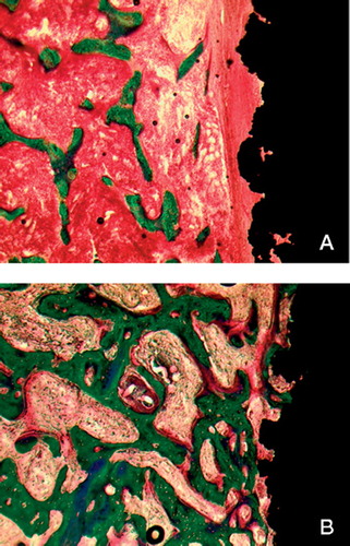 Figure 2. A. Illustration of an uncoated control implant. Adjacent to the implant (black) there is a thick rim of fibrous tissue (red, arranged longitudinally), and there is very little bone (green) in the gap. B. Illustration of a growth factor-treated implant. There is abundant bone (green) on the implant surface, and no fibrous tissue.