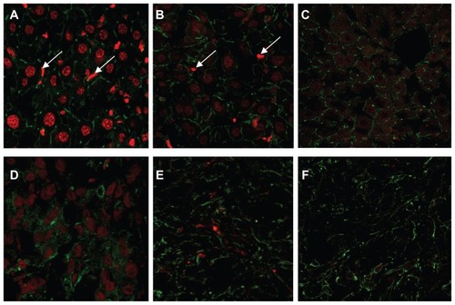 Figure 6 Confocal micrographs of tissue from female tumor-bearing nude mice injected with different formulations of DOX, 4 hours prior to euthanasia. The tissue section was labeled for cytoskeletal filamentous actin with Alexa Fluor 488® conjugated with phalloidin. (A) Lac-L-DOX in liver, (B) L-DOX in liver, (C) free DOX in liver, (D) Lac-L-DOX in tumor, (E) L-DOX in tumor, and (F) free DOX in tumor.Note: The white arrows denote Kupffer cells.Abbreviations: DOX, doxorubicin; L-DOX, liposomal doxorubicin; Lac-L-DOX, lactosylated liposomes encapsulating doxorubicin.
