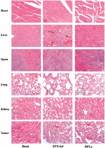 Figure 8. Histological examination of heart, liver, spleen, lungs, kidney, and tumor slices excised from A549 tumor-bearing nude mice on the 22th day after the respective treatment with saline, DTX-Sol and DPLs.