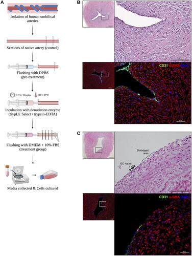 Figure 1. (A) Schematic of the denudation setup. (B) The structure of native artery with intact EC layer from H&E and immunofluorescent (IF) staining. (C) The structure of denuded artery with EC free area. Scale bars 500 µm and 200 μm (for H&E); 100 μm and 25 μm (for IF staining).
