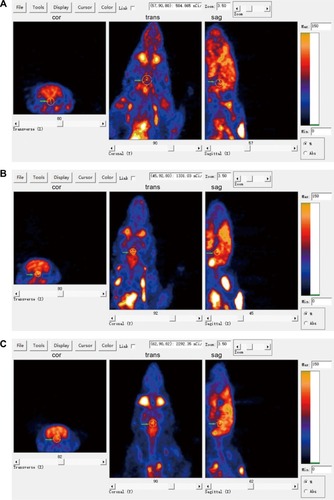 Figure 4 PET images with 18F-FDG of control and tumor group rats.