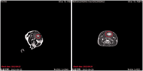 Figure 2. Representative T1-weighted MR images in the same C6 glioma rat by (A) day 7 and (B) day 14 after implantation. The zone in circle indicates the tumour area.