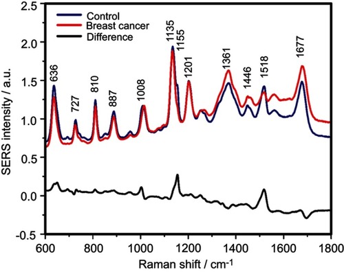 Figure S2 The mean surface-enhanced Raman scattering (SERS) spectra of serum from controls and breast cancer patients and their difference. The SERS spectra were acquired by focusing a 532 nm laser (10 mW) on the samples for 40 s. The SERS spectra were mean normalized and for each spectrum, two measurements were averaged