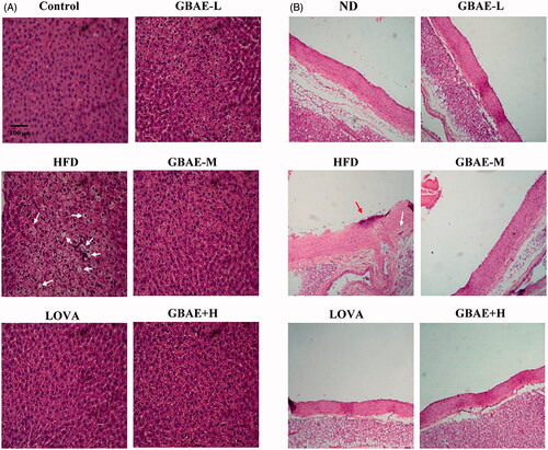 Figure 1. Pathologic examination of the livers and thoracic aortas of SD rats treated with GBEE for 12 weeks. SD rats consuming a HFD were subdivided into GBEE-L, GBEE-M, and GBEE-H, and control groups and orally administered 4, 8, or 16 mg/kg BW GBEE or 40 mg/kg BW LOVA as a positive control, respectively. After H&E staining, pathologic examinations of the hepatic tissues (A) and the thoracic aorta (B) were performed. Fatty liver changes, steatosis, and endothelial inflammation are indicated by arrows.