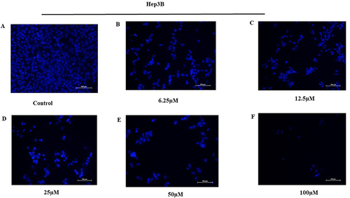 Figure 5 Effect of KP on the induction of apoptosis and cell cycle. Hep3B cells were treated (A) without and with (B) 6.25µM (C) 12.5µM (D) 25µM (E) 50µM (F) 100µM of KP respectively for 48h and visualized under a fluorescence microscope. The cell showed typical apoptotic morphological features upon KP treatment.