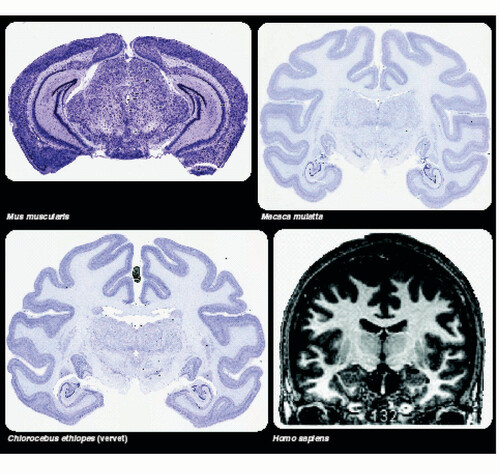 Figure 1. Coronal images of Nissl stained sections from Mus musculus, Chlorocebus aethiops, Macaca mulatta, and MRI of human cortex Citation[135].