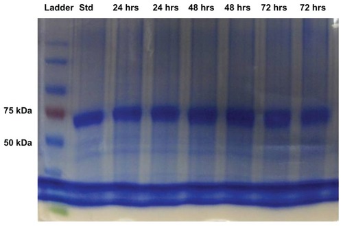 Figure 2 Sodium dodecyl sulphate-polyacrylamide gel electrophoresis images of protein standard marker, bovine serum albumin standard and bovine serum albumin released from microneedles after 24, 48, and 72 hours.