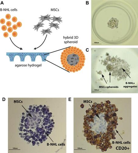 Figure 1 Culture and staining of B-NHL spheroids. (A) Schematic illustration of the assembly of a 3D hybrid spheroid. Stromal cells (HS-5) aggregate densely, while lymphoma cells evenly surround the stromal cell core. (B) Lymphoma/MSCs hybrid spheroids (ratio 1:1) formed within agarose gel within 24 h. (C) Co-culture of HS-5 and Ri-1 cells in a “hanging drop” after 72 h of incubation. MSCs form multiple spheroids variable in size, while lymphoma cells are assembled into a flat, irregular aggregate. (D) Hematoxylin staining of FFPE spheroids (ratio 1:2 of Ri-1:HS-5) in agarose gel. (E) Immunohistochemical staining shows CD20 positive lymphoma cells surrounding the CD20 negative stromal cells, which self-aggregate in the center of the spheroid.