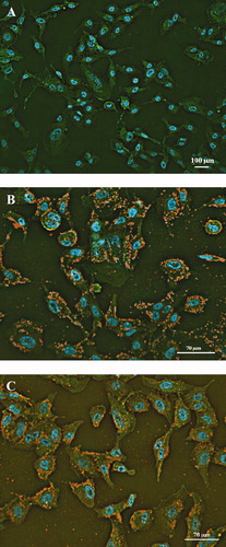 Figure 1. Adherence patterns of H. capsulatum yeast to pneumocytes. Immunofluorescence staining of non-infected pneumocytes (A). Infection after incubation for 7 h with the EH-315 strain in pneumocytes (B) and the 60I strain in pneumocytes (C). Phalloidin-FITC (green); DAPI (blue); anti-Histoplasma polyclonal serum plus Alexa 594-conjugated antibody (red-to-yellow). The assays were conducted in an IN Cell Analyzer 2000 using light microscopy.
