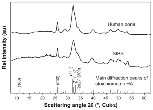 Figure 6 Representative XRD pattern of the biomaterial, the main diffraction peaks of stoichiometric HA and for comparison a diffraction pattern human bone. The measurements prove that HA is the only crystal phase in our biomaterial. The peak broadening of synthetic hydroxyapatite is similar to that of biological hydroxyapatite in human bone, indicating a comparable crystal size in both samples.Abbreviations: XRD, X-ray diffraction; HA, hydroxyapatite.