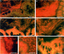 Fig. 2 Bacterial colonies adjacent to the normal rat and human gut epithelium. Rat colon (A–F) or human appendix (G) was flushed with OCT preservative, Flash-frozen, cut, stained with acridine orange and examined by fluorescent microscopy. Longitudinal (parallel to flow of bowel contents) sections (A–D) and transverse (perpendicular to flow of bowel contents) sections (E and F) were cut. Longitudinal sections of the ascending colon (A and B) and the transverse colon (C and D) are shown at 2 different magnifications. Transverse sections of the ascending colon (E) and transverse colon (F) are also shown. The human appendix (G) was sectioned longitudinally. Results are representative of 9 rats and 5 humans. The bars represent 30 μm (A, C, and G) and 15 μm (B and D–F).