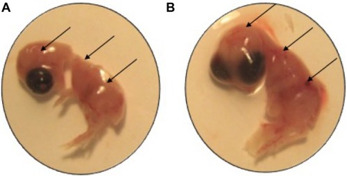 Figure 2 Outcome of SWCNTs on the chicken embryo at 12 days of incubation.Notes: The SWCNTs-exposed embryo (A) is smaller in comparison with its matched control (B). Additionally, we note that SWCNTs inhibit blood vessels development in SWCNTs-treated embryo in comparison with the control (arrows). The embryos were treated by 25 μg of SWCNTs at 3 days of incubation, reprinted from Nanomedicine, 2013;9(7), Roman D, Yasmeen A, Mireuta M, Stiharu I, Al Moustafa AE, Significant toxic role for single-walled carbon nanotubes during normal embryogenesis, Pages 945–950,Citation28 Copyright ©2013, with permission from Elsevier.Abbreviation: SWCNTs, single-walled carbon nanotubes.