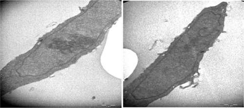 Figure 4 Transmission electron micrographs of NIH/3T3 cell (16,500×) not treated with folic acid-modified magnetic nanoparticles.