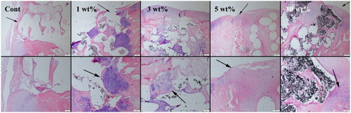 Figure 6. Representative histopathological micrographs of defect areas (thin arrows) of the control, 1%, 3%, 5% and 10% graphene-containing PCL groups (upper row) at 8 weeks, higher magnification (row below), cartilage proliferation areas (thick arrows), Haematoxylin-eosin staining, scale bar = 200 µm (for upper row) and 100 µm (for the row below).