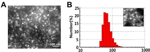 Figure 1 The characterization of CSNPs. (A) TEM image of CSNPs. (B) DLS measurements of CSNPs.