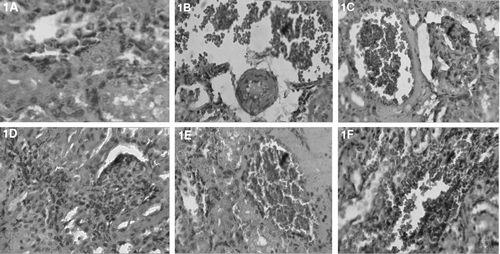 Figure 1.  Photomicrographs of kidney sections of rat stained with haematoxylin and eosin (×100). (A) Hemotoxylin and eosin-stained sections of normal rat kidney. (B) Kidney section of 2% gum acacia + APAP treated rats showing focal areas of tubular necrosis, swelling, infiltration of RBCs and tubular brush border loss. (C) Kidney section of normal saline + APAP-treated rats showing marked tubular necrosis, swelling and flattening of proximal tubular cells with brush border loss and infiltration of RBCs. (D) Kidney section of rutin (20 mg/kg) + APAP-treated rats showing almost normal mucosa with very less degree of RBCs infiltration and flattening of proximal tubular cells with brush border loss. (E) Section of MECH (400 mg) + APAP-treated rat kidney showing minimal degree of inflammatory cells with RBCs infiltration and there is a decreased flattening of proximal tubular cells with brush border loss. (F) Kidney section of PEECH (400 mg) + APAP-treated rat showing moderate degree of RBCs infiltration and flattening of proximal tubular cells with brush border loss.