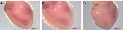 Figure 4 Images of chicken embryo heart.Notes: Experimental solutions were administered in ovo by injection of 0.3 mL PBS containing 5,000 μg/mL hydrocolloids of nanoparticles into the air sack. (A) Control heart and after the administration of (B) ND or (C) GR.Abbreviations: CAM, chorioallantoic membrane; PBS, phosphate buffered saline; ND, diamond nanoparticles; GR, graphite nanoparticles.