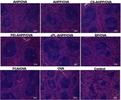 Figure 6 HE staining of spleens of immunized mice at day 35 after final vaccination. Scale bar represents 100 nm.