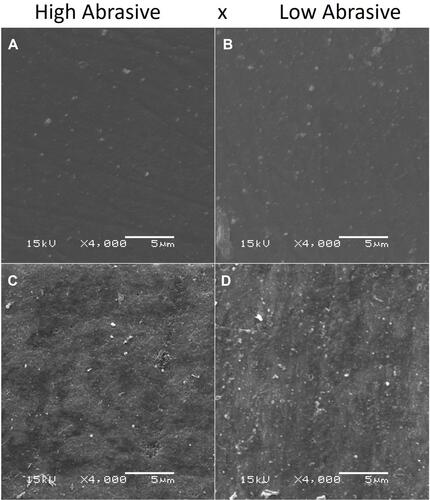 Figure 2 Enamel: (A) and (B) with bleaching and without erosion; (C) and (D) with bleaching and with erosion.