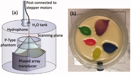 Figure 1. Schematic of the experimental setup used for hydrophone scanning. (a) Hydrophone scanning setup with the placement of the thinner P-Type phantom shown in the testing column. (b) Photo of one heterogeneous P-Type phantom with exposed canola-oil inclusions before the final gelatin pour. Phantom diameter is 10.2 cm with a height of 3 cm. The testing column suspended the phantom such that positional accuracy was assured under all testing conditions.