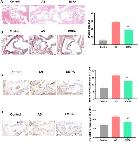 Figure 1 Empagliflozin attenuated atherosclerotic lesion areas. Representative HE staining (A), Movat staining (B), CD68 immunohistochemistry (C) ang MCP-1 immunohistochemistry (D) of Sham, AS and EMPA group. #p<0.05, ##p<0.01.