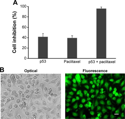 Figure 6 The nanocapsules contained p53 and paclitaxel, which can synergistically induced cell apoptosis.Notes: (A) Growth inhibition rate (%) of Hela cells after treatment with nanocapsules of p53 (50 μg/mL), paclitaxel (50 μg/mL), or both of them. The data were expressed as mean ± SEM (n%4). (B) Apoptotic cells treated with nanocapsules containing p53 and paclitaxel observed under optical and fluorescence microscope. Scale bar 20 μm.Abbreviation: SEM, standard error of mean.