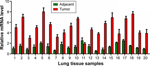 Figure 1 Expression patterns of NLK in SCLC and adjacent lung tissues.