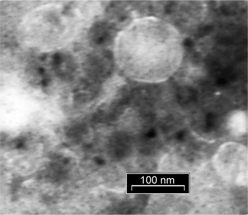 Figure 1 Electron microscopic analysis of phage. SR ϕ1 observed with a TEM analysis. Scale bar, 100 nm.Abbreviation: TEM, transmission electron microscopy.